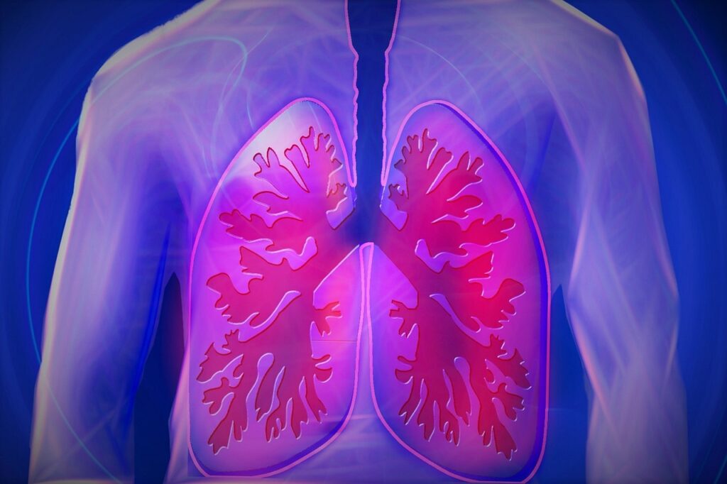 image showing signs and symptoms of lung cancer