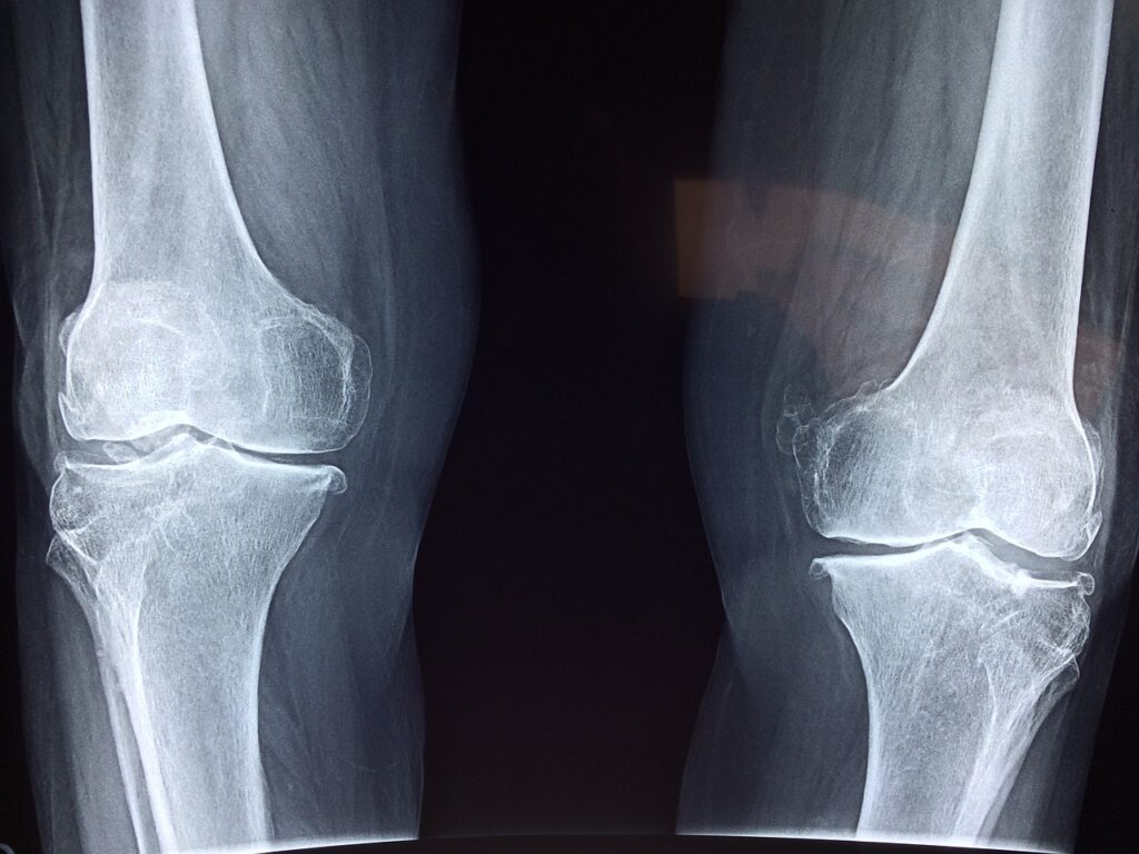 Image of a skeletal framework showing the joints of the human body